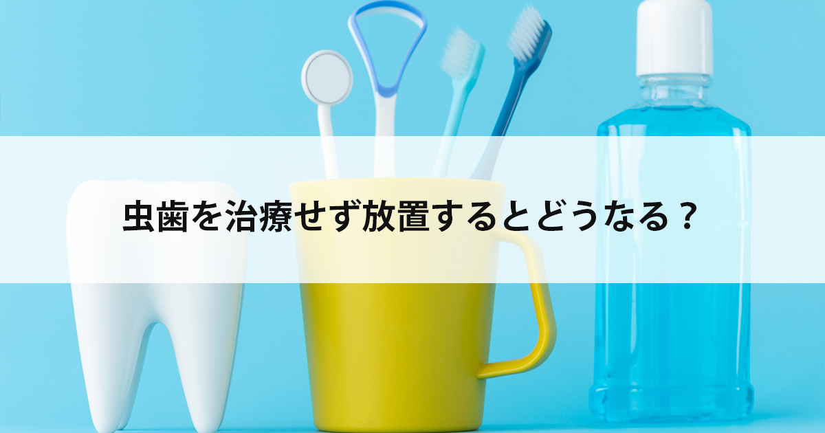 【新潟市中央区新潟駅の歯医者】虫歯を治療せず放置するとどうなる?