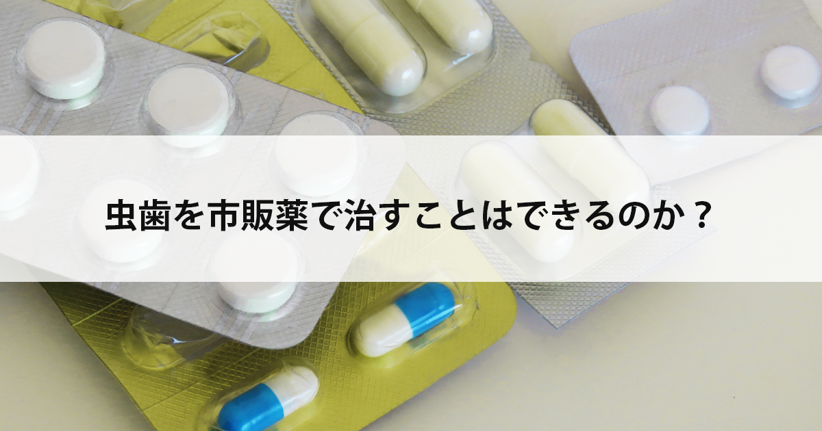 【新潟市中央区新潟駅の歯医者】虫歯を市販薬で治すことはできるのか?