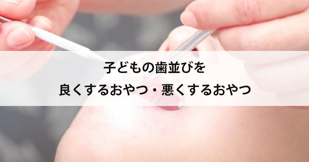 【新潟市中央区新潟駅の歯医者・小児歯科】子どもの歯並びを良くするおやつ・悪くするおやつ