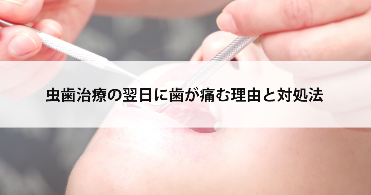 【新潟市中央区新潟駅の歯医者で虫歯治療】虫歯治療の翌日に歯が痛む理由と対処法
