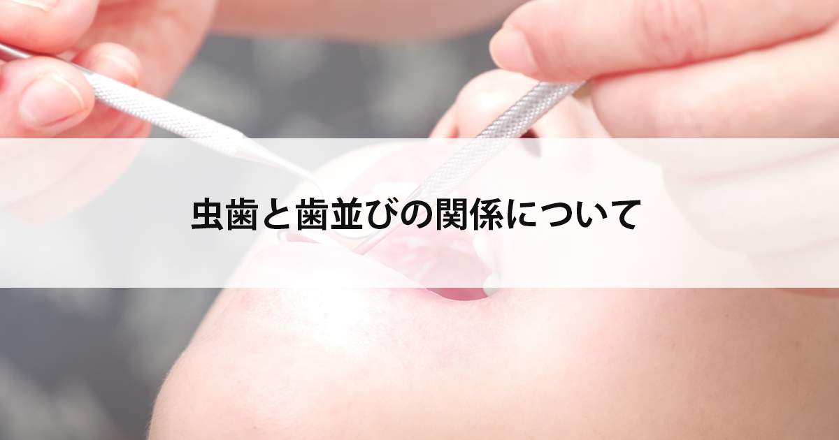 【新潟市中央区新潟駅の歯医者で虫歯治療】虫歯と歯並びの関係について