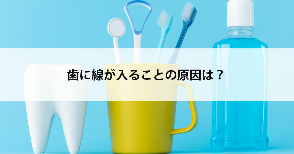 【新潟市中央区新潟駅の歯医者で虫歯治療】歯に線が入ることの原因は?