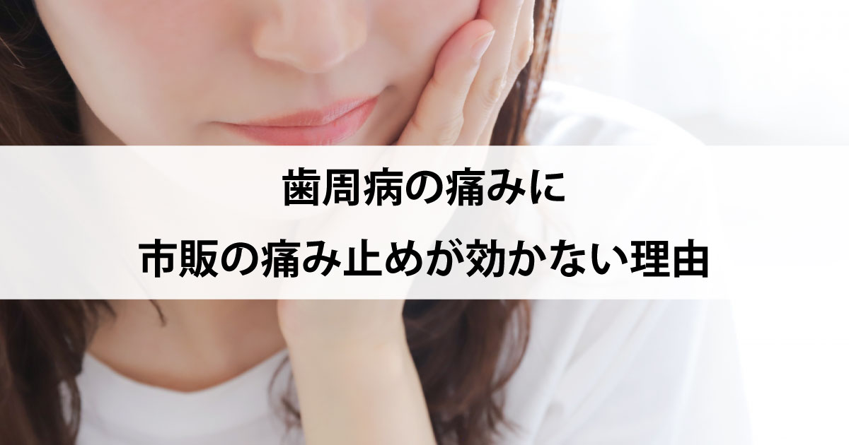 【新潟市中央区新潟駅の歯医者で歯周病治療】歯周病の痛みに市販の痛み止めが効かない理由