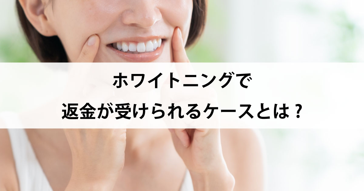 【新潟市中央区新潟駅の歯医者でホワイトニング】ホワイトニングで返金が受けられるケースとは?