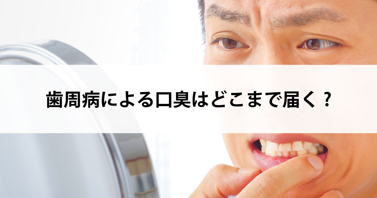 【新潟市中央区新潟駅の歯医者で歯周病治療】歯周病による口臭はどこまで届く?