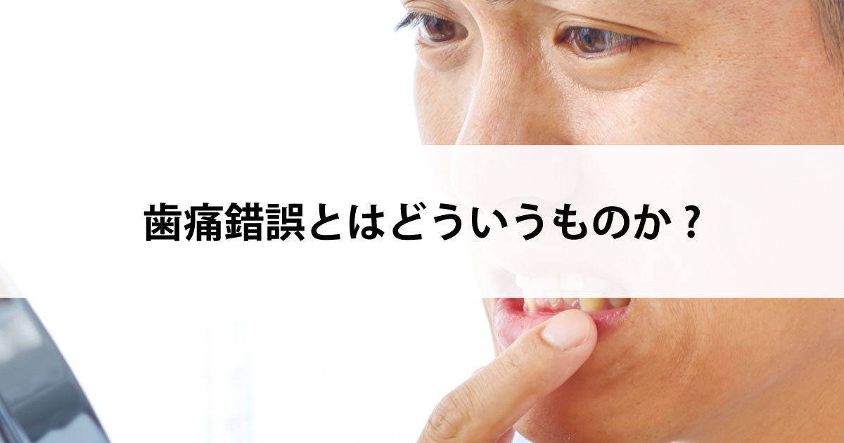 【新潟市中央区新潟駅の歯医者で虫歯治療】歯痛錯誤とはどういうものか?