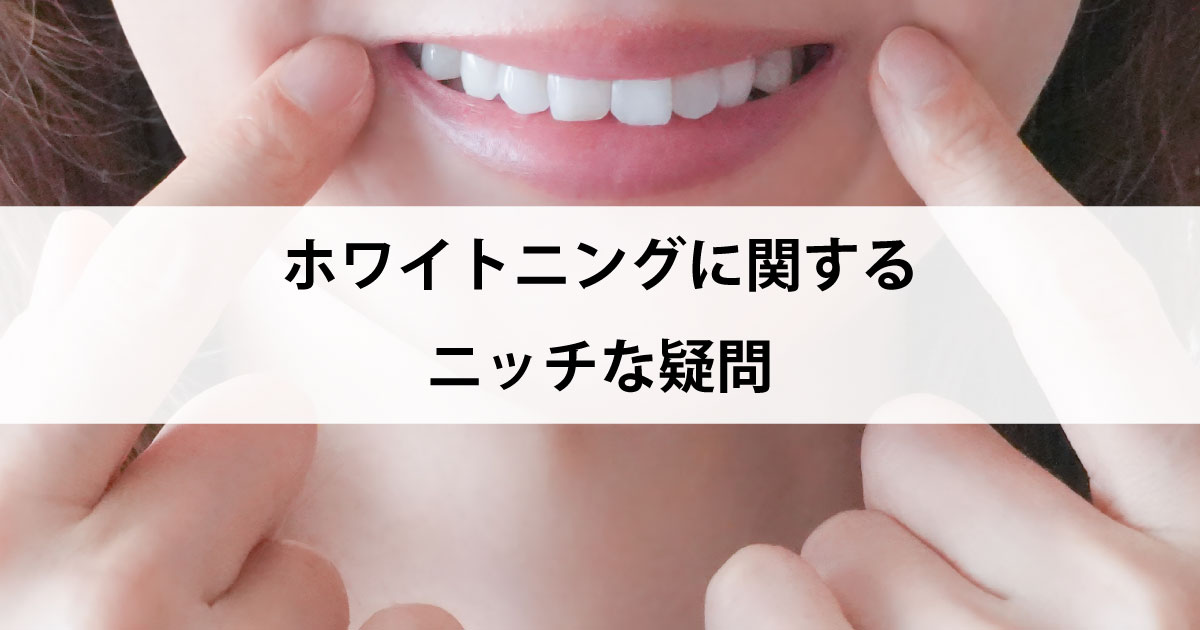 【新潟市中央区新潟駅の歯医者でホワイトニング】ホワイトニングに関するニッチな疑問