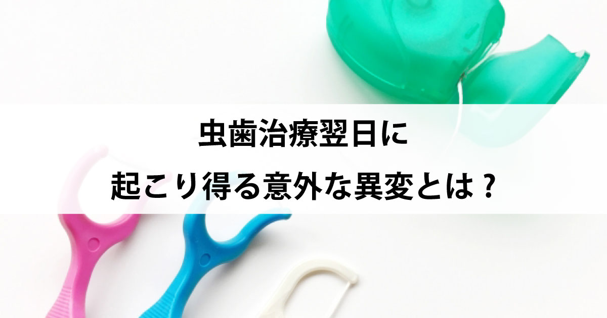 【新潟市中央区新潟駅の歯医者で虫歯治療】虫歯治療翌日に起こり得る意外な異変とは?