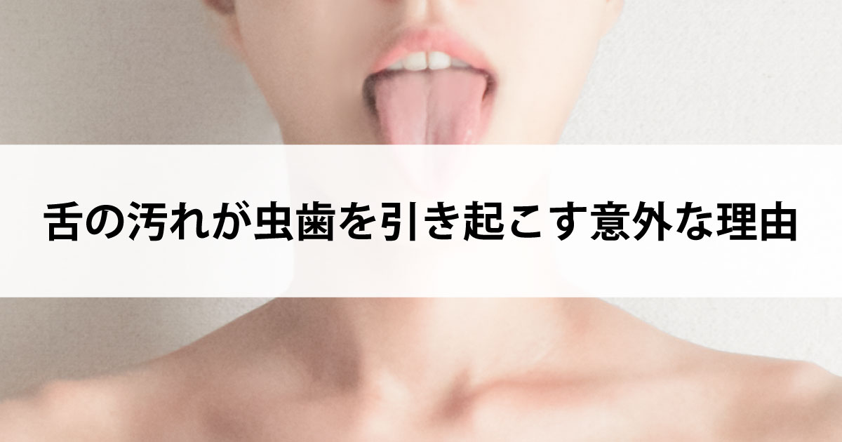 【新潟市中央区新潟駅の歯医者・予防歯科】舌の汚れが虫歯を引き起こす意外な理由