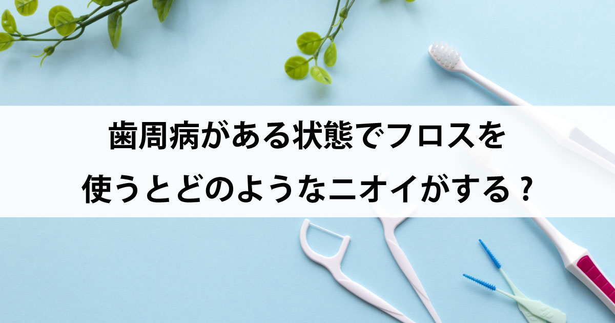 【新潟市中央区新潟駅の歯医者で歯周病治療】歯周病がある状態でフロスを使うとどのようなニオイがする?
