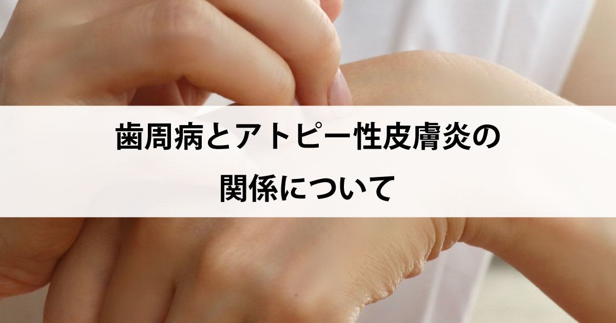 【新潟市中央区新潟駅の歯医者で歯周病治療】歯周病とアトピー性皮膚炎の関係について
